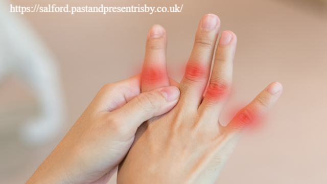 Gejala dan Tanda Asam Urat di Tangan